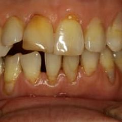 39位のイメージ