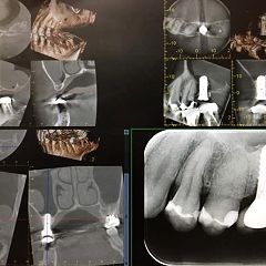 11位のイメージ