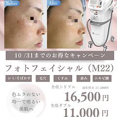 19位のイメージ