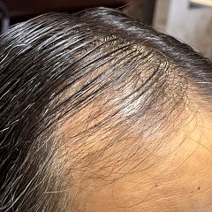 151位のイメージ