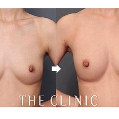 20位のイメージ