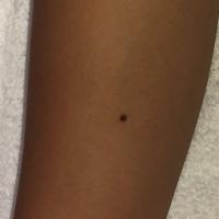 10位のイメージ