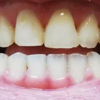 28位のイメージ