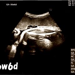 41位のイメージ