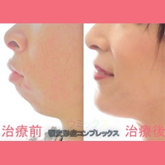 29位のイメージ