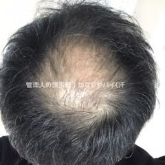 28位のイメージ