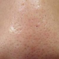 73位のイメージ