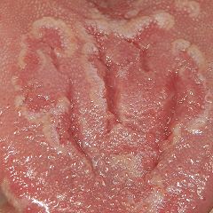 21位のイメージ